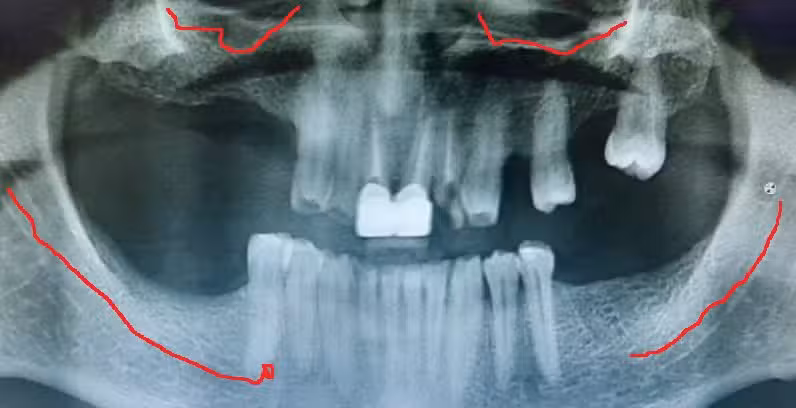 Odontologia Del Cabildo Ni&ntilde;os y Adultos