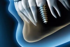 Odontologia integral monte grande R.A.F