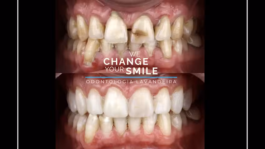 Odontolog&iacute;a Lavandeira