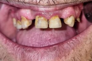 ODONTOLOG&Iacute;A ROCCA