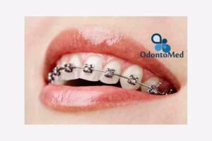 OdontoMed. ORTODONCIA.