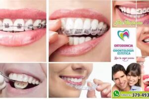 Ortodoncia corrientes