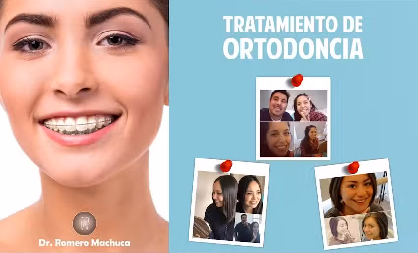 Ortodoncia Dr. Romero Machuca