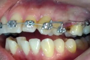 Ortodoncia Implantes SN
