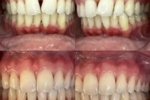 Ortodoncia Julieta Schreiber