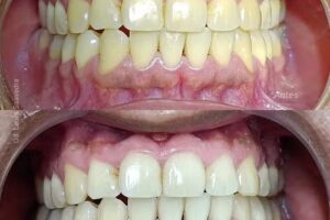 Ortodoncia – Od. Laura Saavedra