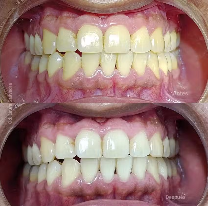 Ortodoncia &ndash; Od. Laura Saavedra