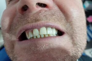 Urgencias odontol&oacute;gicas